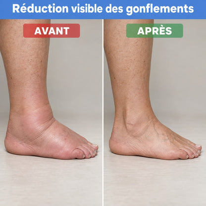 KinePulse™ Masseur 3 en 1 pour talons douloureux et pieds gonflés